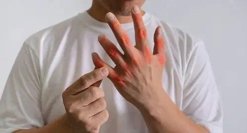 Memahami Asam Urat: Dampaknya Terhadap Kekakuan Jari